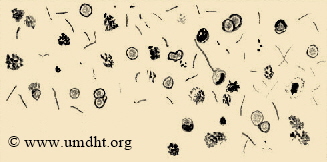Shigella dysenteriae: Stbchenfrmiges, nicht-sporenbildendes, Gram-negatives, nicht-bewegliches Bakterium, welches in sauterstofffreiem Milieu existiert; benannt nach seinem Entdecker Kiyoshi Shiga.
