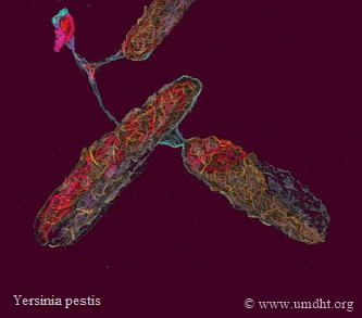 Yersinia pestis Yersinia pestis